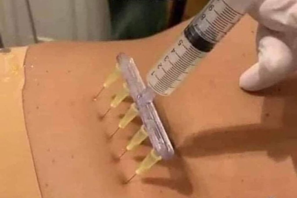 5 dávek najednou očkování proti variantě SIGMA, která je v plánu na červenec roku 2022